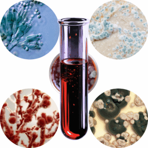 Alergia na mieszankę pleśni