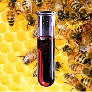 Allergy to bee venom